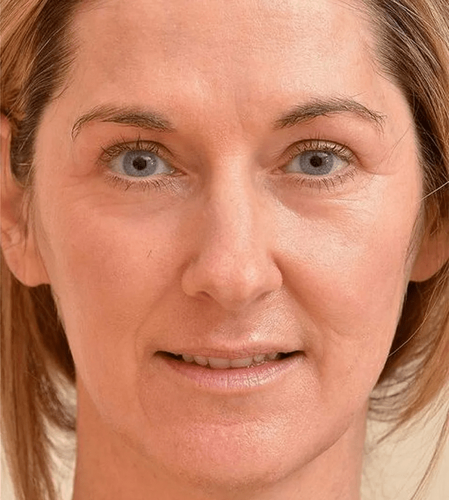 Paréceme máis novo despois de aplicar crema Eudalie